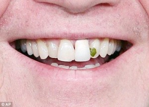 spinach-in-teeth
